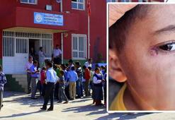 İlkokulda korkunç olay! Çocuğun yüzünde sigara söndüren temizlik görevlisi tutuklandı