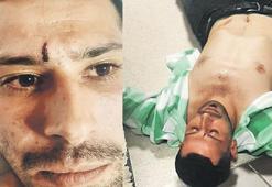 Başkan yardımcısından 'rabia' işareti dayağı