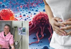 55 yaşındaki kadın şişkinliği görmezden geldi! Meğer 17 santimetrelik tümörü varmış