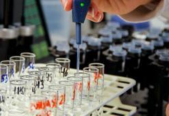 Enzim Devi Novonesis’e idari para cezası