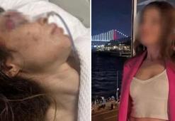 Genç kadına dehşeti yaşatmıştı! İşte cani boksöre istenen ceza