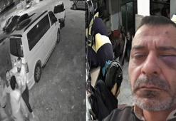 Sosyal medya fenomeni boşanma aşamasındaki eşi ve ailesi tarafından öldüresiye darp edildi