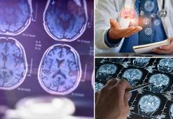 Sadece 13 kişide görüldü! Nadir hastalıklara bir yenisi eklendi