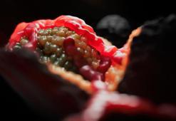 En ölümcül kanser türünde umut veren gelişme: 3 çocuk annesinin ömrünü uzattı