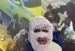 Çakmakla yakılan kadına kan donduran mesajlar: 'Kız arkadaşım sizin yüzünüzden hapse girdi...'