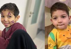 Küçük Beykan yaşam mücadelesi veriyor! 'Bir tüp kan, bir can demek'