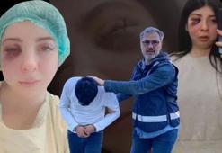 Damla'yı sokak ortasında öldüresiye dövmüştü: Tahliye edilen sanık için savcıdan ceza talebi!