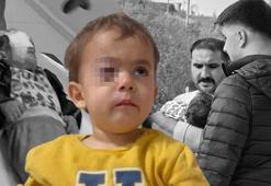 2 yaşındaki Alperen gözünden oldu! 'Fırıncıya satmasın diye yalvarmıştım'