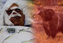 Kentte ayı dehşeti! 1 ayda 5'inci vaka! 'Ameliyatla kemikleri yerine koyduk'