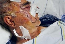 Yüzünü ayı parçaladı!