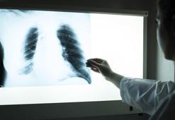 40 yaş üstündeki her 10 kişiden 1'i KOAH hastası