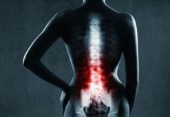 Omurga romatizması geç kalmadan tedavi edilmeli!