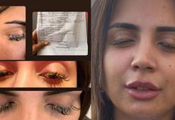 Güzellik merkezinde kabus! Genç kadının gözüne yapıştırıcı kaçtı: Gözlerim göremez hale geldi