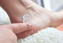 Topuk çatlaklarını anında geçiriyor! Ayakları bebek gibi yumuşatıyor, 5 dakikada etki ediyor!