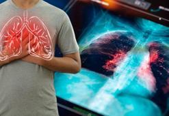 Derin bir nefes alın: Akciğerlerinizi güçlendirmenin en etkili yolu