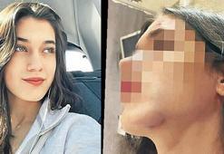 Eski sevgili dehşeti