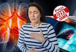 Akci&#x11F;er kanseri erken evrede yakalanabilir mi? Uzman isim &#x27;kritik e&#x15F;i&#x11F;i&#x27; a&#xE7;&#x131;klad&#x131;