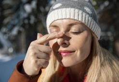 Soğuk havalarda en çok bu cilt rahatsızlıkları görülüyor!