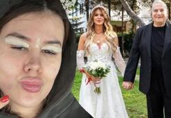 Mehmet Ali Erbil'in kendisinden 40 yaş küçük eşi Gülseren Ceylan göz kapağını aldırdı