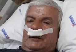 65 yaşındaki adamın burnundan 100 gramlık taş çıkarıldı taş çıkarıldı