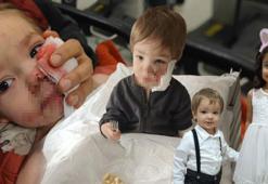 2 kardeşe saldırıp hastanelik etti! Pitbull sahibinden pişkin savunma