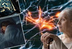 Masum görünen şekerleme Alzheimer habercisi mi? Bilim insanlarından çarpıcı araştırma