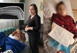 9 yaşında akran zorbalığı! Arkadaşının kolunu iki yerinden kırdı: 'Öğretmene şikayet ettiği için yaptım'