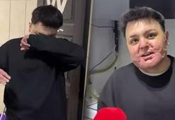 8 ayda 65 ameliyat geçirdi! 15 yaşındaki Engin'in hayatı kabusa döndü: Babamdan özür diledim!