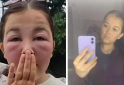 Masum görünen bakım rutini kabusa döndü! Ünlü markanın ürünü dehşeti yaşattı