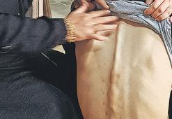 Engelli gence bakım merkezinde şiddet iddiası