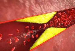 Üstüne para verseler bile bu gıdaları tüketmeyin! Damarları tıkıyor