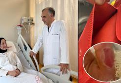 Sıcak su torbası patladı, vücudunun yüzde 25'i yandı! Masum görünüyor ama çok tehlikeli!