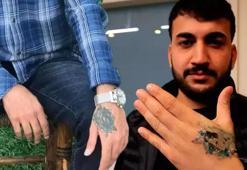 Dövme sildirmek isterken kabusu yaşadı: 'Eczaneden ağrı kesici al'