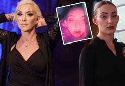 Güllü'nün kızının darp edilmiş halde görüntüleri çıktı! 'Annem yaptı, gebersinler'