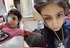 Gözlük faciası! Plastik sandılar, cam çıktı: 8 yaşındaki Şeyma sağ gözünü kaybetti