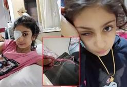 Masum alışveriş, ağır bedel: Gözlük camı gözüne saplandı