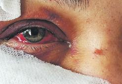 Koca şiddetinin korkunç tablosu