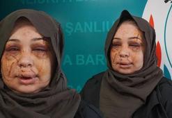 Ankara'da eşine dehşeti yaşatan polis tutuklandı! Bakanlardan peş peşe açıklama