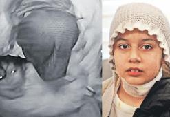 Bıçaklanan Hüda'yı atkısı kurtarmış