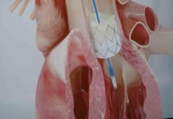 Genç yaştaki ani ölümlerde korkutan gerçek: Yüzde 90’ı bu sebepten kaynaklanıyor