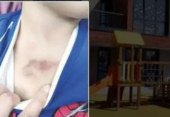 İBB kreşinde istismar ve darp iddiası! Mağdur çocuğun ifadesi dehşete düşürdü