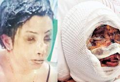 Kadına karşı vahşet