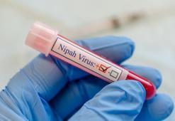 Nipah virüsü nedir, nasıl bulaşır, Türkiye'de var mı? Nipah virüsü belirtileri nelerdir, nasıl ortaya çıkar?