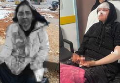 Boşanmak istemeyen kocadan dehşet! 'İfadeni geri çek' deyip kaldırım taşıyla dövdü