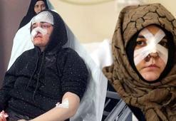 Kaldırım taşıyla saldırdı, Nazlı'nın kabusu oldu: Ayaklarımın üzerinde dursaydım ona dönmezdim