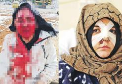 Nazlı’nın çığlığını duyun!