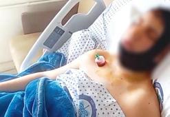 Lisede akran dehşeti! Omuriliği ve çenesi kırıldı