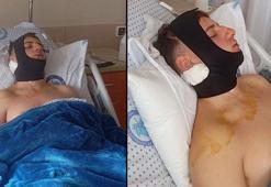 Darbettikleri öğrencinin omuriliğini ve çenesini kıran 4 şüpheli tutuklandı