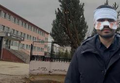 Fizik öğretmeni rehberlikçiyi kaynar çayla yakmıştı! Lisedeki akılalmaz olayda karar