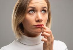 Uçukları anında gideriyor! Doğal uçuk kremi, 2 malzemeyle hazırlanıyor